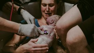 Read more about the article Empowering Mothers: Midwifery Skills That Matter